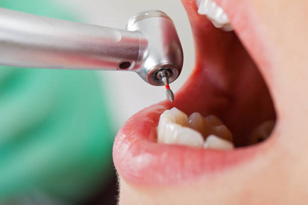 Best Broken or Chipped Tooth Repair in Manhasset Hills, NY